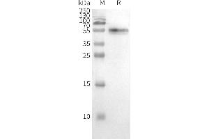 WB analysis of Human -Nanodisc with anti- monoclonal antibody (ABIN7455959 and ABIN7490920), followed by Goat Anti-Human IgG HRP at 1/5000 dilution (CCR2 Protein)