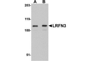 Western Blotting (WB) image for anti-Leucine Rich Repeat and Fibronectin Type III Domain Containing 3 (LRFN3) (Middle Region) antibody (ABIN1030988) (LRFN3 antibody  (Middle Region))