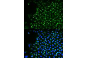 Immunofluorescence analysis of U2OS cell using PDHA1 antibody. (PDHA1 antibody)