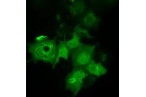 Immunofluorescence (IF) image for anti-Chromosome 21 Open Reading Frame 59 (C21orf59) antibody (ABIN1497043) (C21orf59 antibody)