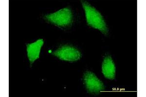 Immunofluorescence of purified MaxPab antibody to PPM1F on HeLa cell. (PPM1F antibody  (AA 1-454))