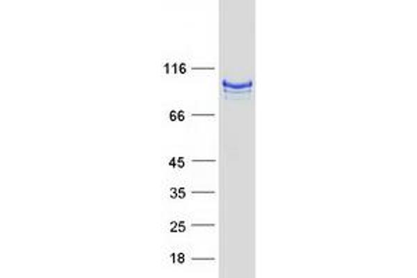 ITIH2 Protein (Myc-DYKDDDDK Tag)