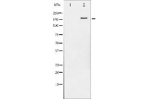 Western blot analysis of HER2 phosphorylation expression in EGF treated MDA-MB-231 whole cell lysates,The lane on the left is treated with the antigen-specific peptide. (ErbB2/Her2 antibody  (pTyr877))