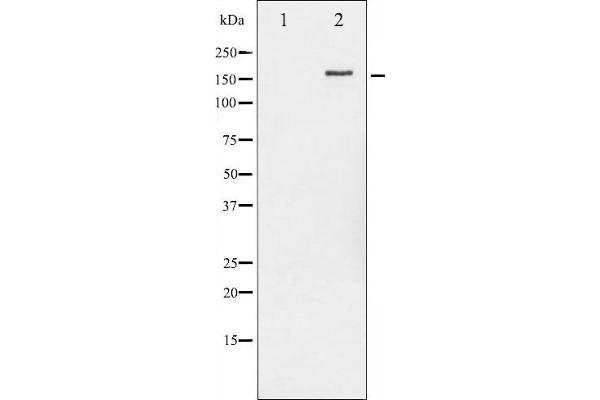 ErbB2/Her2 antibody  (pTyr877)