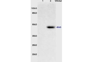 Lane 1: mouse brain lysates Lane 2: human colon carcinoma lysates probed with Anti PIM1 Polyclonal Antibody, Unconjugated (ABIN700510) at 1:200 in 4 °C. (PIM1 antibody  (AA 251-350))