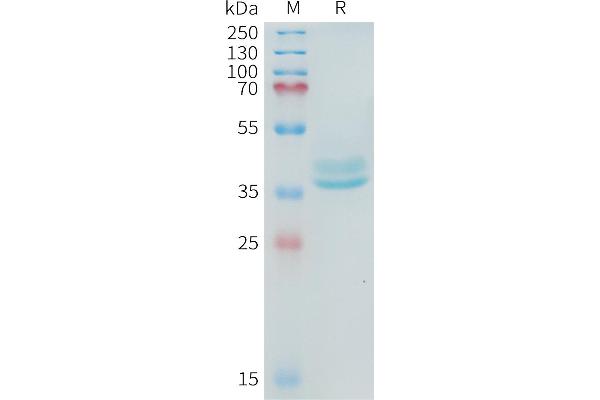 ADAM17 Protein (AA 581-642) (Fc Tag)