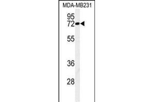 Western blot analysis of C Antibody (N-term) (ABIN650926 and ABIN2839997) in MDA-M cell line lysates (35 μg/lane). (CJ119 (AA 143-171), (N-Term) antibody)