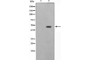 Western blot analysis on HeLa cell lysate using ZNF174 Antibody,The lane on the left is treated with the antigen-specific peptide. (ZNF174 antibody  (Internal Region))