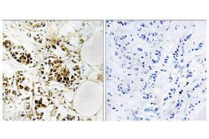 Immunohistochemistry (IHC) image for anti-Regulator of G-Protein Signaling 5 (RGS5) (Internal Region) antibody (ABIN1852006) (RGS5 antibody  (Internal Region))