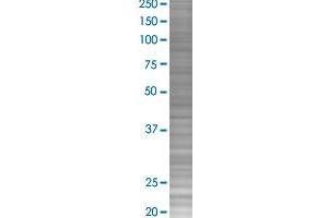 SGCE transfected lysate. (SGCE 293T Cell Transient Overexpression Lysate(Denatured))