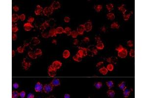 Immunofluorescence analysis of HeLa cells using CYP3A7 Polyclonal Antibody at dilution of 1:100 (40x lens). (CYP3A7 antibody)