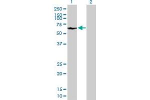 Western Blot analysis of A1CF expression in transfected 293T cell line by A1CF MaxPab polyclonal antibody. (A1CF antibody  (AA 1-594))