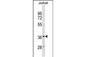 Western blot analysis in Jurkat cell line lysates (35ug/lane). (HMOX2 antibody  (N-Term))