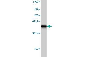 Western Blot detection against Immunogen (37. (ODZ1/Teneurin 1 antibody  (AA 2616-2725))