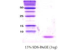 Figure annotation denotes ug of protein loaded and % gel used. (alpha Synuclein 96140 (active) Protein)