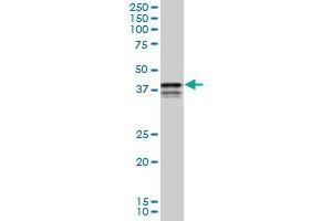 PCBP2 monoclonal antibody (M04), clone 3A1. (PCBP2 antibody  (AA 1-362))