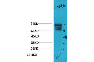 Western Blotting (WB) image for anti-Signal Transducer and Activator of Transcription 3 (Acute-Phase Response Factor) (STAT3) antibody (ABIN3188048) (STAT3 antibody)