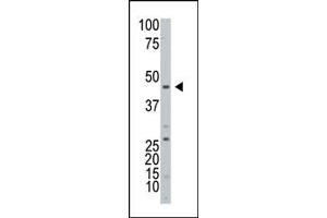 Western Blotting (WB) image for anti-ADP-Ribosyltransferase 3 (ART3) (C-Term) antibody (ABIN357664) (ART3 antibody  (C-Term))