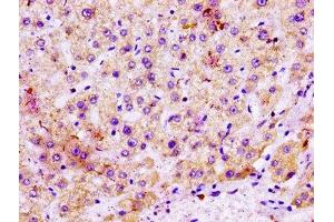 IHC image of ABIN7159722 diluted at 1:100 and staining in paraffin-embedded human liver tissue performed on a Leica BondTM system. (MGST1 antibody  (AA 63-96))