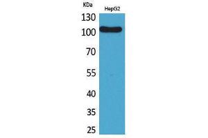 Western Blotting (WB) image for anti-Fc Receptor-Like 5 (FCRL5) (Internal Region) antibody (ABIN6287249) (FCRL5 antibody  (Internal Region))