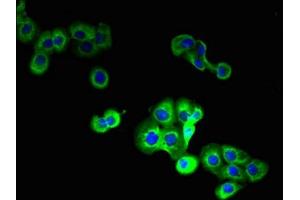 Immunofluorescent analysis of A431 cells using ABIN7159501 at dilution of 1:100 and Alexa Fluor 488-congugated AffiniPure Goat Anti-Rabbit IgG(H+L) (STEAP1 antibody  (AA 3-69))