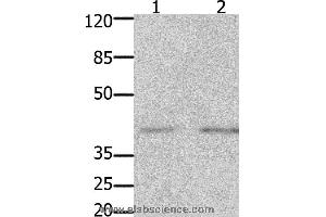 Western blot analysis of Human fetal kidney and  brain tissue, using GFRA3 Polyclonal Antibody at dilution of 1:1000 (GFRA3 antibody)