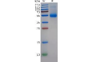 MIF Protein (AA 2-115) (Fc Tag)