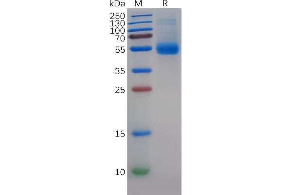 MIF Protein (AA 2-115) (Fc Tag)