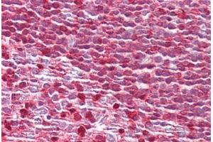 Anti-MTOR antibody IHC staining of human tonsil. (MTOR antibody  (AA 2415-2464))
