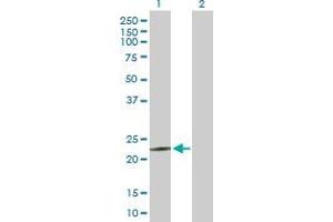 Lane 1: MED18 transfected lysate ( 23. (MED18 293T Cell Transient Overexpression Lysate(Denatured))