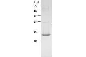 Western Blotting (WB) image for Estrogen Receptor 1 (ESR1) (AA 1-116) protein (His tag) (ABIN7284938) (Estrogen Receptor alpha Protein (AA 1-116) (His tag))