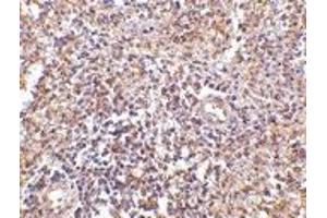 Immunohistochemistry (IHC) image for anti-Ubiquitin Interaction Motif Containing 1 (UIMC1) (N-Term) antibody (ABIN1031531) (UIMC1 antibody  (N-Term))