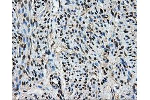 Immunohistochemical staining of paraffin-embedded Kidney tissue using anti-BRAFmouse monoclonal antibody. (BRAF antibody)