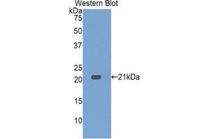 Western blot analysis of the recombinant protein. (HDGF antibody  (AA 14-187))