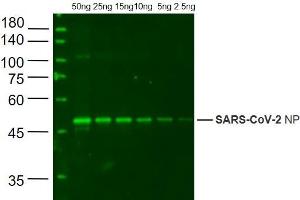 Recombinant SARS-CoV-2 N Protein probed with ABIN6952440 at 1:1000 (SARS-CoV-2 Nucleocapsid antibody  (AA 1-419))