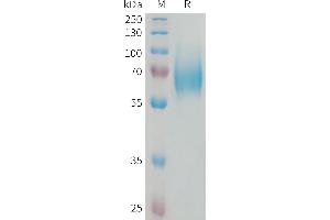 FGFR1 Protein (AA 22-376) (His tag)