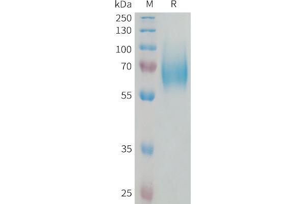 FGFR1 Protein (AA 22-376) (His tag)