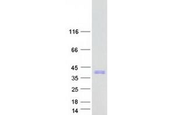 SRA1 Protein (Myc-DYKDDDDK Tag)