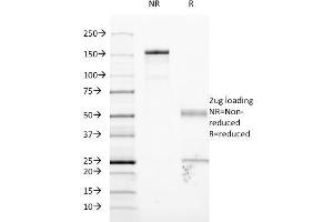 SDS-PAGE Analysis Purified CD54 Monoclonal Antibody (W-CAM-1). (ICAM1 antibody)