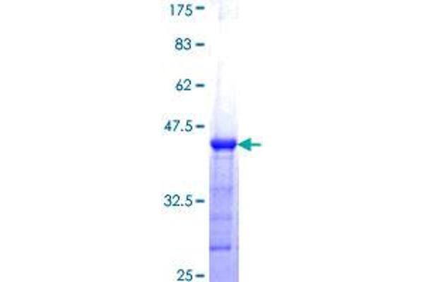 Calcineurin B Protein (CAN) (AA 1-110) (GST tag)