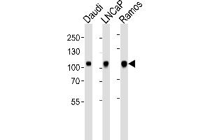 Western blot analysis of lysates from Daudi, LNCaP, Ramos cell line (from left to right), using E Antibody (N-term) (ABIN6243093 and ABIN6577478). (MME antibody  (N-Term))