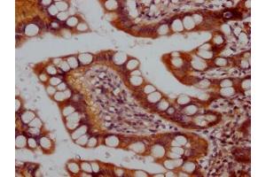 IHC image of ABIN7127787 diluted at 1:100 and staining in paraffin-embedded human small intestine tissue performed on a Leica BondTM system. (Recombinant Raptor antibody)