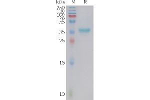 GAL Protein (AA 20-123) (Fc Tag)