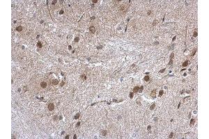 IHC-P Image Nucleoporin p62 antibody detects Nucleoporin p62 protein at nuclear envelope on mouse fore brain by immunohistochemical analysis. (NUP62 antibody)