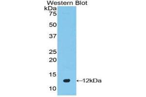 Western Blotting (WB) image for anti-Defensin beta 2 (BD-2) (AA 21-71) antibody (ABIN1858623) (beta 2 Defensin antibody  (AA 21-71))