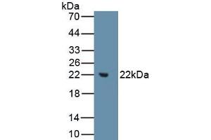 Detection of Recombinant MMP3, Human using Polyclonal Antibody to Matrix Metalloproteinase 3 (MMP3) (MMP3 抗体  (AA 247-370))