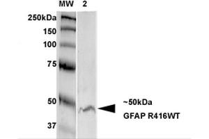 Western Blot analysis of Rat Brain Membrane showing detection of GFAP protein using Mouse Anti-GFAP Monoclonal Antibody, Clone S206B-9 . (GFAP antibody  (AA 411-422) (FITC))