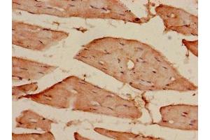 Immunohistochemistry of paraffin-embedded human skeletal muscle tissue using ABIN7172082 at dilution of 1:100 (CDKAL1 antibody  (AA 1-97))