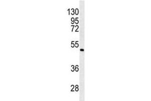 Western blot analysis of ANGPTL6 antibody and K562 lysate. (ANGPTL6 antibody  (AA 206-236))