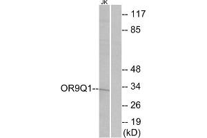 Western blot analysis of extracts from Jurkat cells, using OR9Q1 antibody. (OR9Q1 antibody  (C-Term))